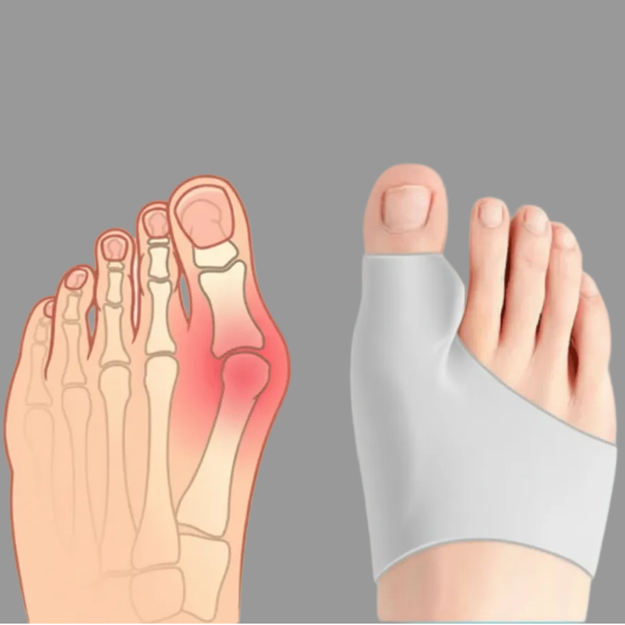 COMPRESSCARE TEEN – Hallux Valgus Corrector for Teenagers