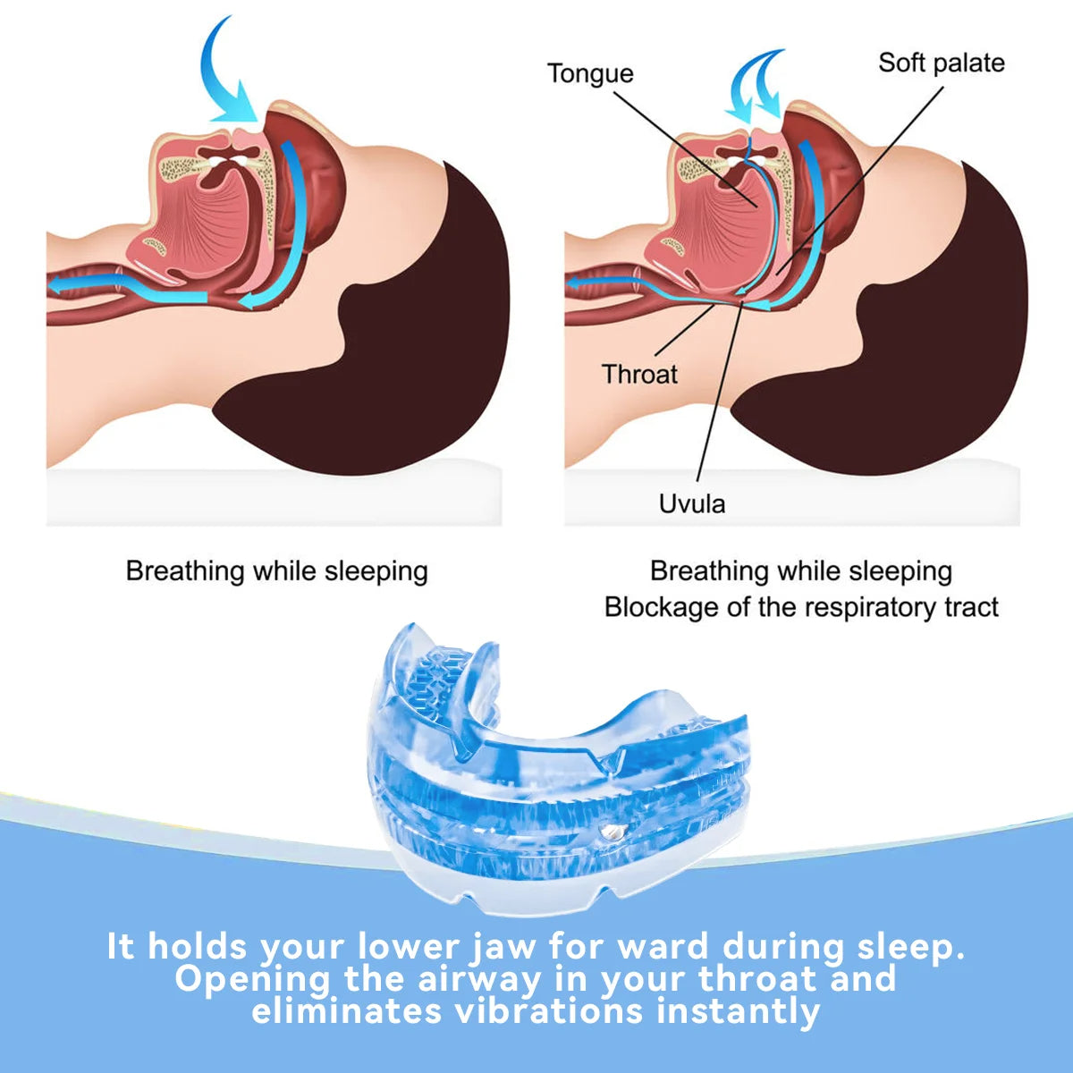 Olvoria | Adjustable Anti-Snoring Mouthguard Made of BPA-Free Material