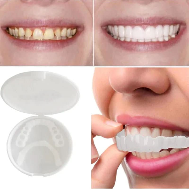 SNAPFIT SMILE – Tooth restoration for a perfect smile without a dentist
