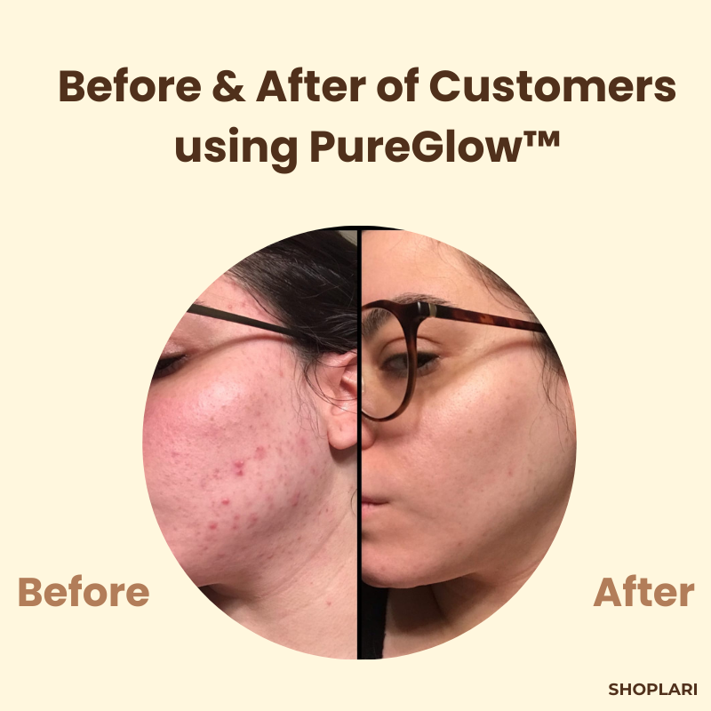 1+1 Free PureGlow™ Black Tea Mask
