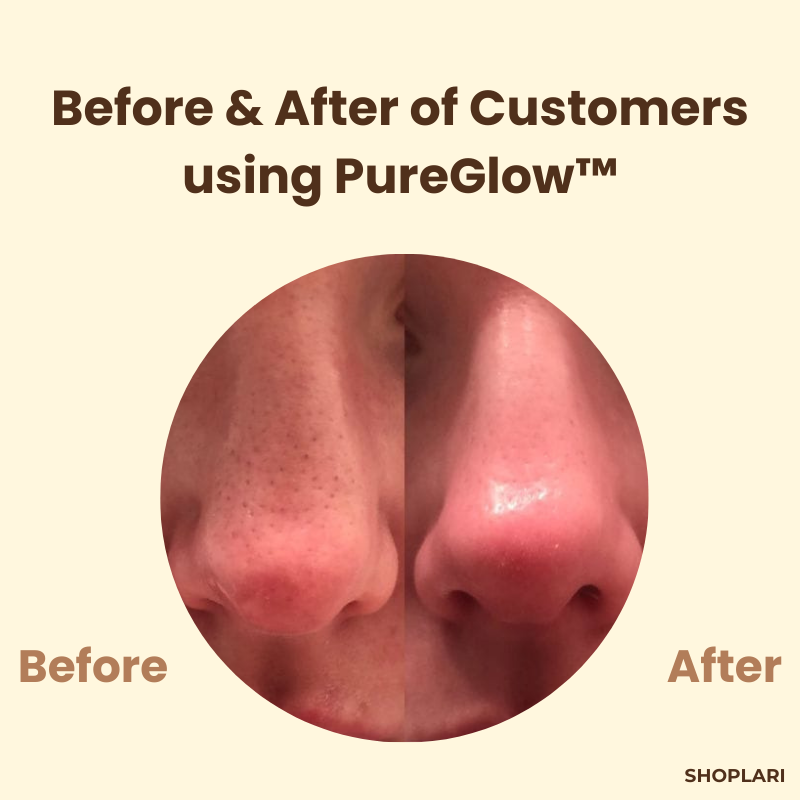 1+1 Free PureGlow™ Black Tea Mask