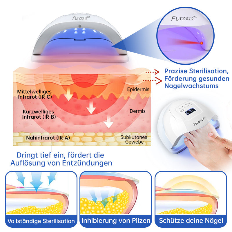 NailCure™ - Nail Fungus Laser Treatment Solution (50% DISCOUNT)