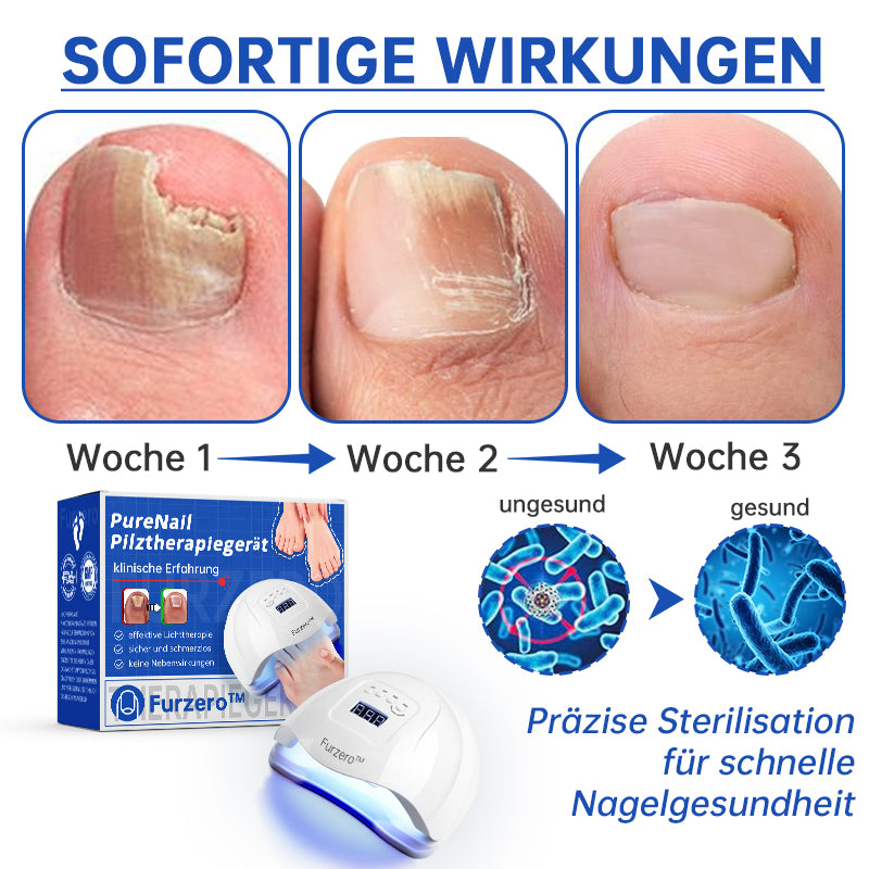 NailCure™ - Nail Fungus Laser Treatment Solution (50% DISCOUNT)
