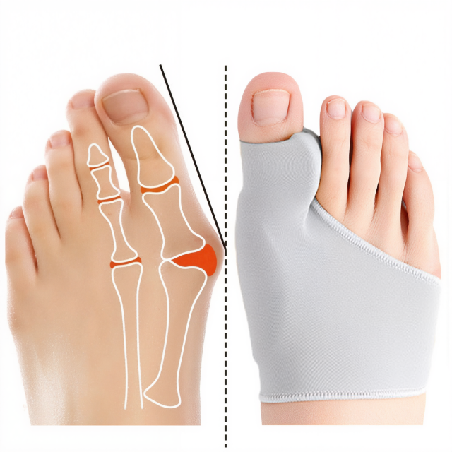 Olvoria | Bunion Corrector Gel Pad Toe Straightener