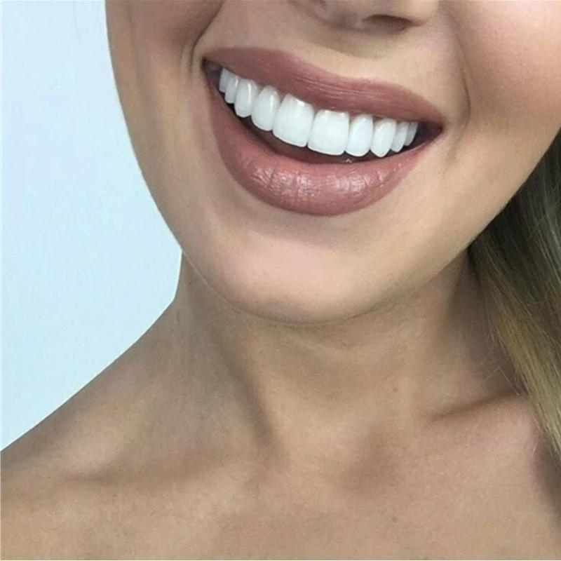 Olvoria | Cosmetic Dental Veneers for Instant Smile Correction