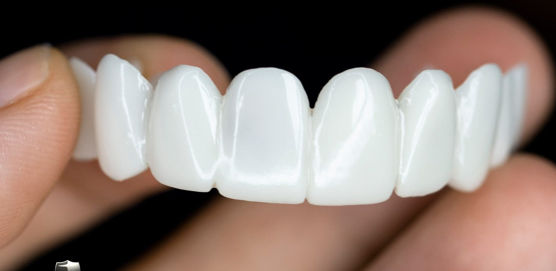 Olvoria | DentAlign Dental Veneers – Natural Fit and Comfort