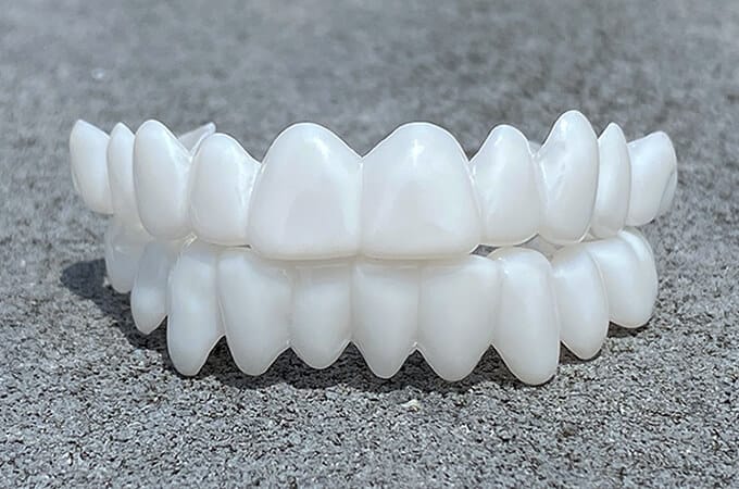 Olvoria | DentAlign Dental Veneers – Natural Fit and Comfort