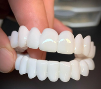 Olvoria | Carillas dentales DentAlign – ajuste natural y comodidad