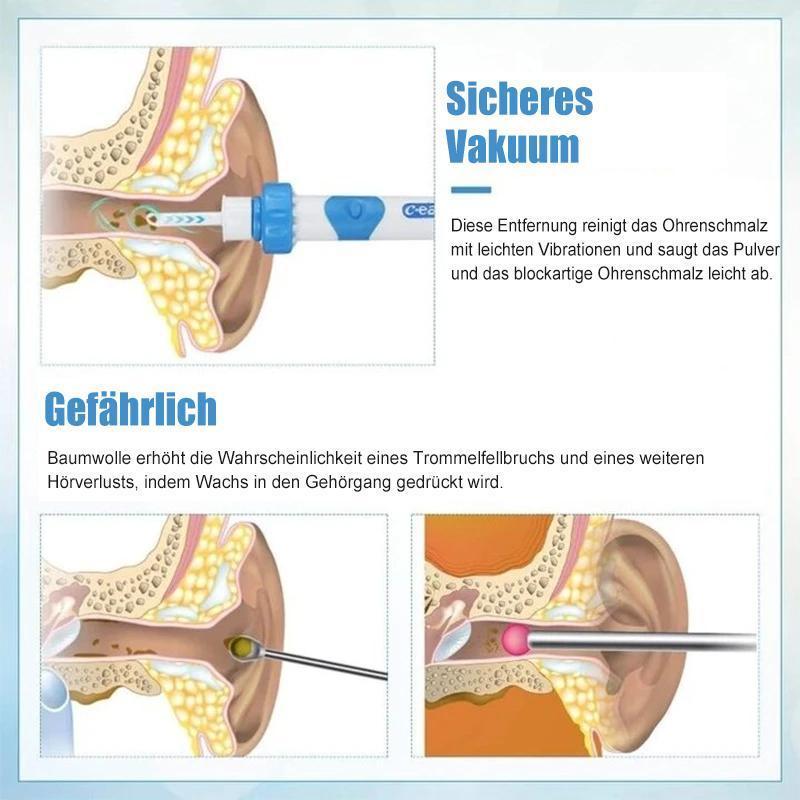 Olvoria | Ear Wax Remover Vacuum