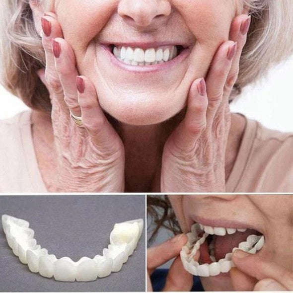 Olvoria | On Smile Veneers (Upper and Lower Jaw included)