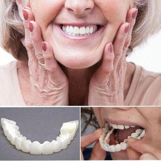 Olvoria | On Smile Veneers (Upper and Lower Jaw included)