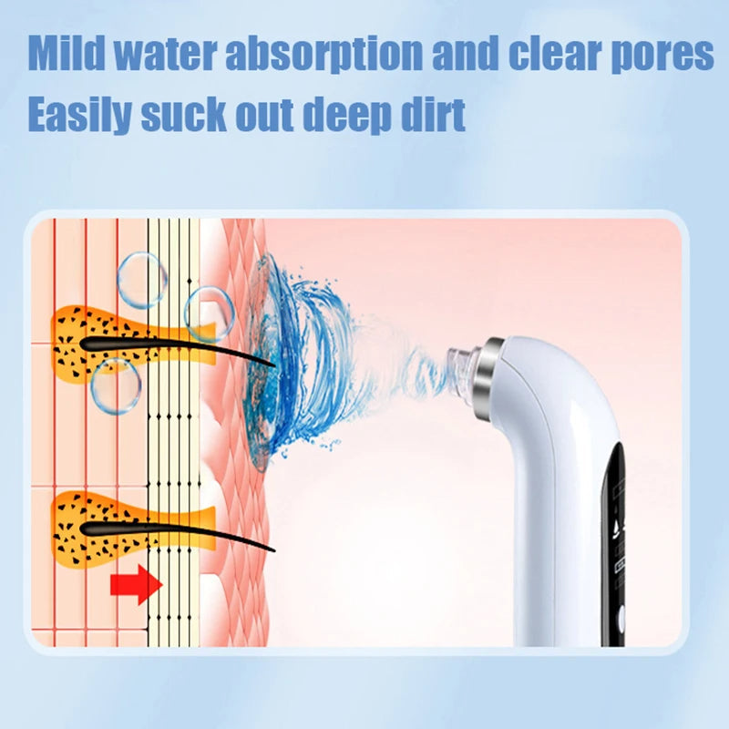 Olvoria | Professional Nose Blackhead Remover Vacuum - Deep Cleansing with Suction Technology