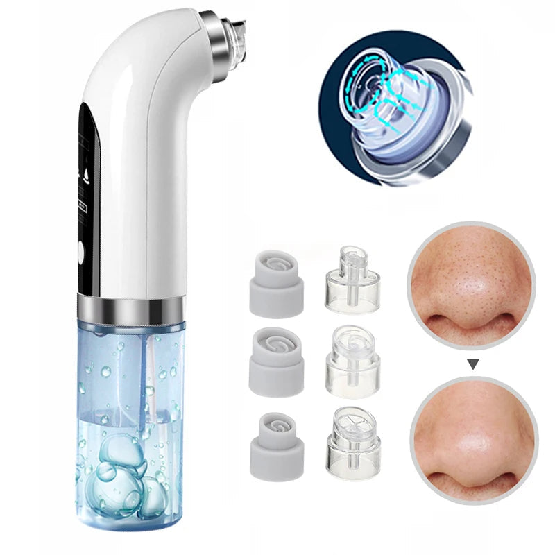 Olvoria | Professional Nose Blackhead Remover Vacuum - Deep Cleansing with Suction Technology