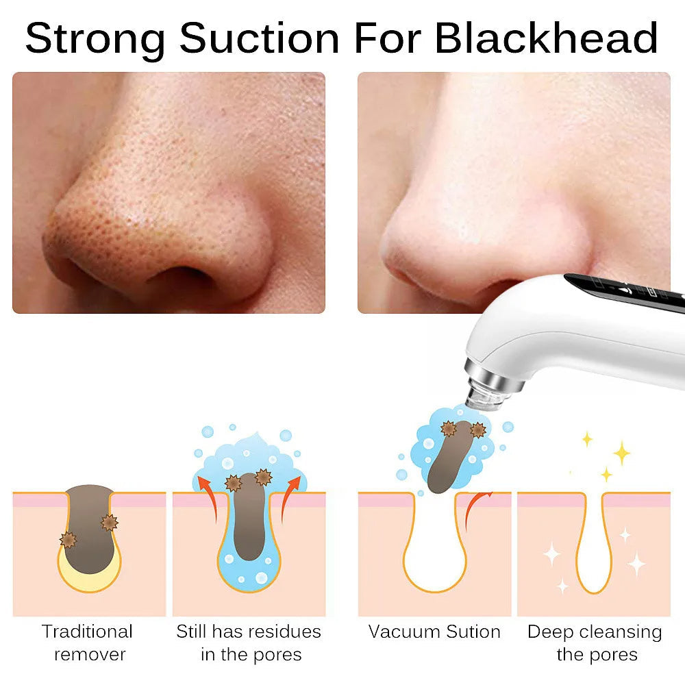 Olvoria | Professional Nose Blackhead Remover Vacuum - Deep Cleansing with Suction Technology