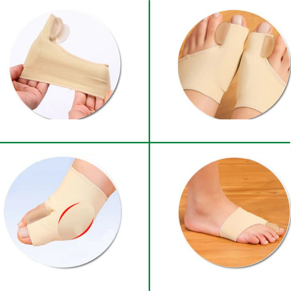 Orthotics for Hallux Valgus