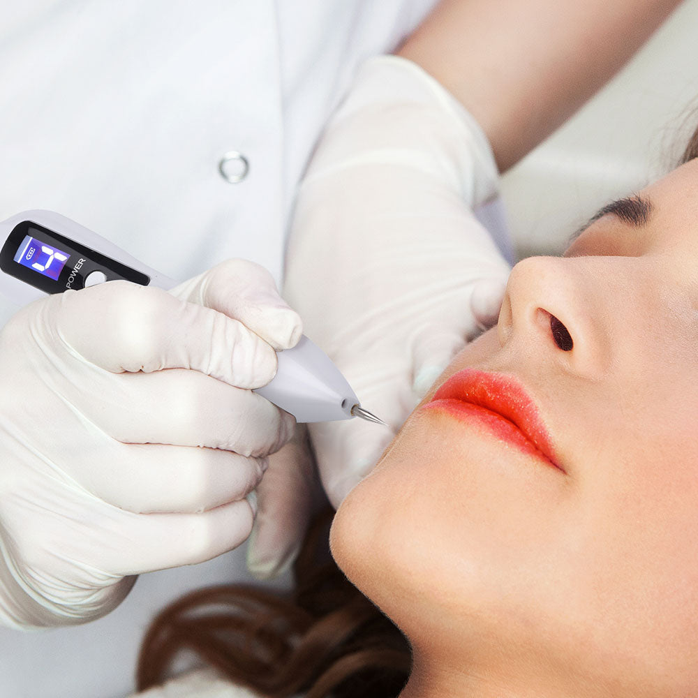 Plasma Pen Skin Tag Remover