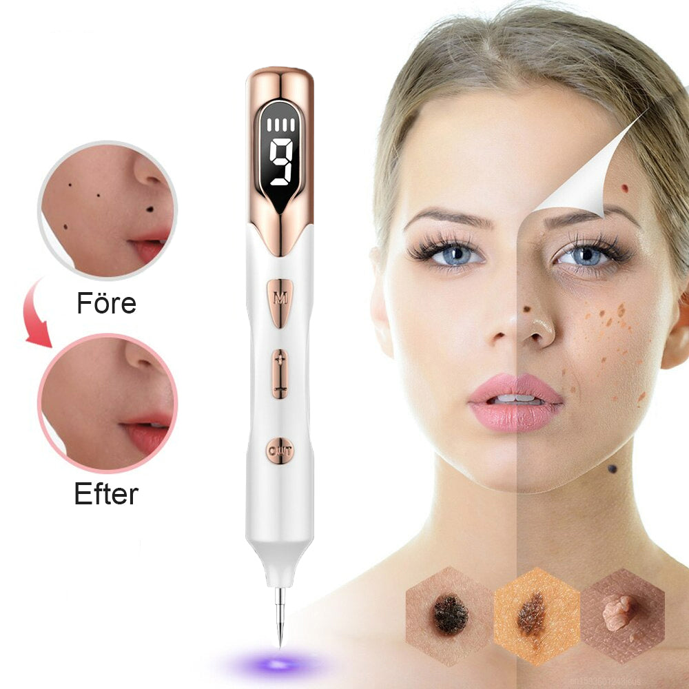 Plasma Pen Skin Tag Remover