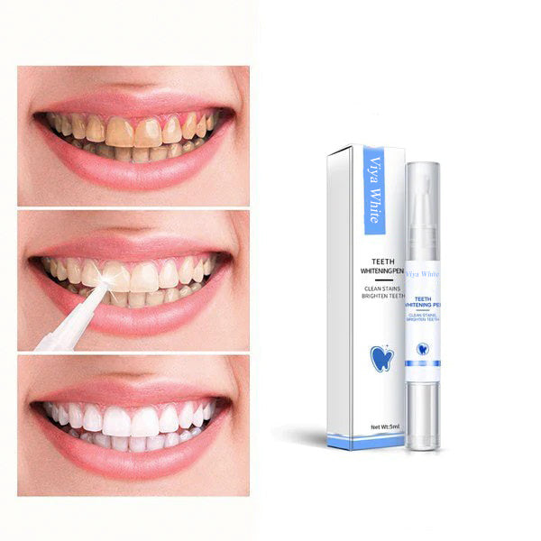 Quick Teeth Whitening for a Radiant Smile